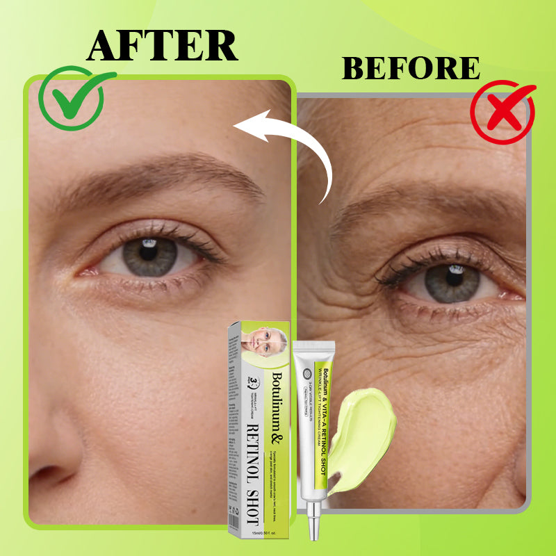 De Vita-A Retinol Precision Shot 🧪 — Geavanceerde lifting voor een jeugdige uitstraling