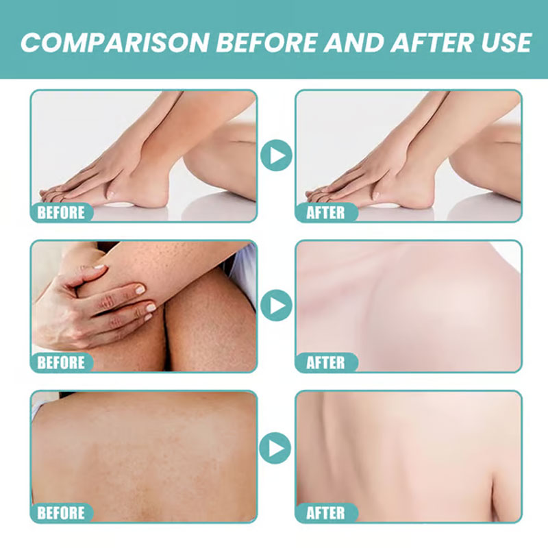 🛁✨Ultra-hydraterende bad- en doucheolie - voor een zijdezachte huid en natuurlijke bescherming tegen muggen