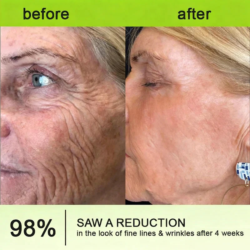 De Vita-A Retinol Precision Shot 🧪 — Geavanceerde lifting voor een jeugdige uitstraling