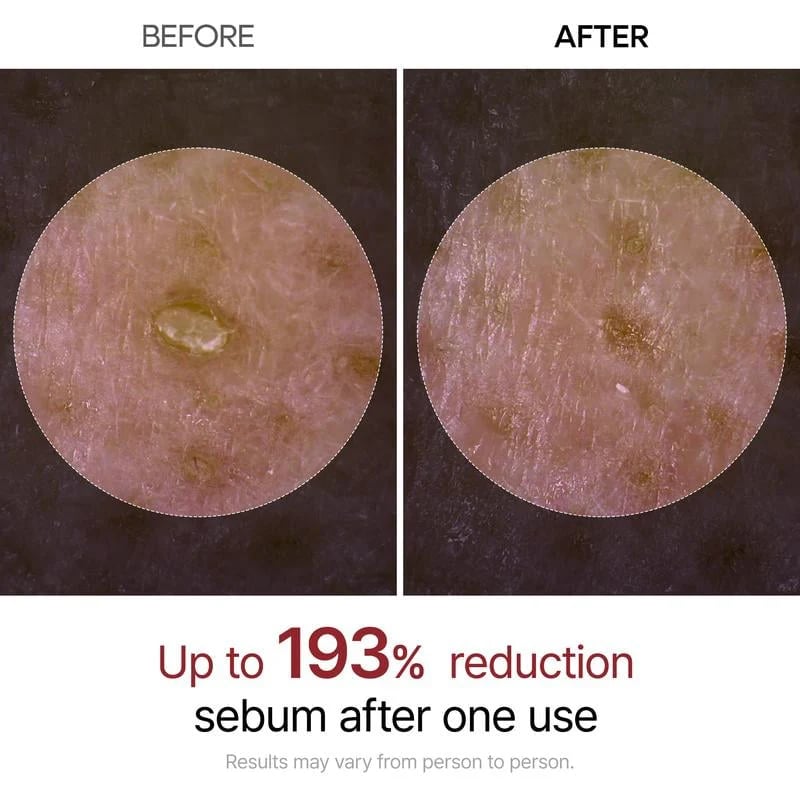 🏆⚡Meer dan 50.000 stuks verkocht! Binnenkort uitverkocht💥🔥 Peel Shot Glow Rice Ampoule Du